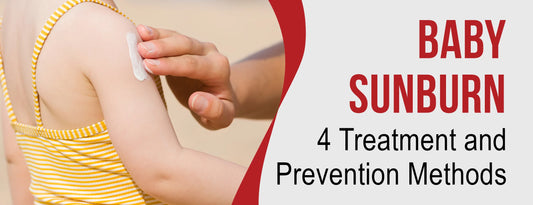 Baby Sunburn: 4 Treatment & Prevention Methods