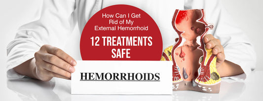 How Can I Get Rid of My External Hemorrhoid: 12 Treatments (Safe)