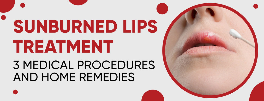 Sunburned Lips Treatment: 3 Medical Procedures & Home Remedies