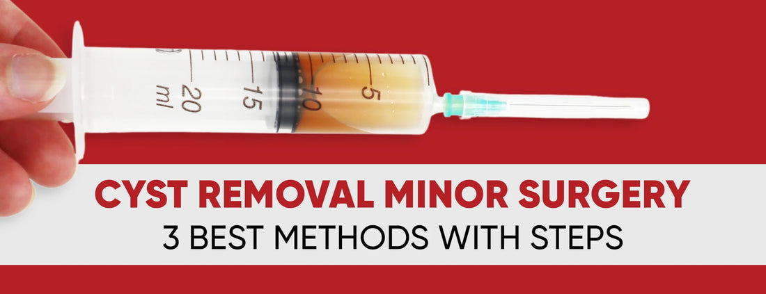 Cyst Removal Minor Surgery: 3 Best Methods [With Steps]