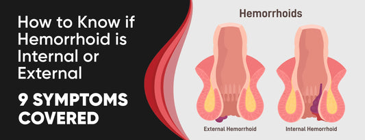 How to Know if Hemorrhoid is Internal or External: 9 Symptoms [Covered]
