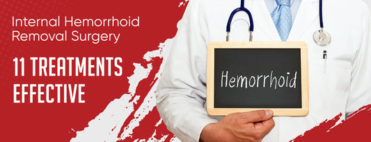 Internal Hemorrhoid Removal Surgery: 11 Treatments [Effective]