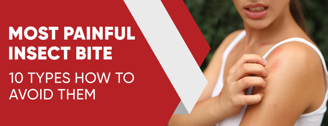 Most Painful Insect Bite: 10 Types [How to Avoid Them]