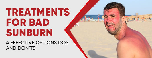 Treatments For Bad Sunburn: 4 Effective Options [Dos & Don’ts]